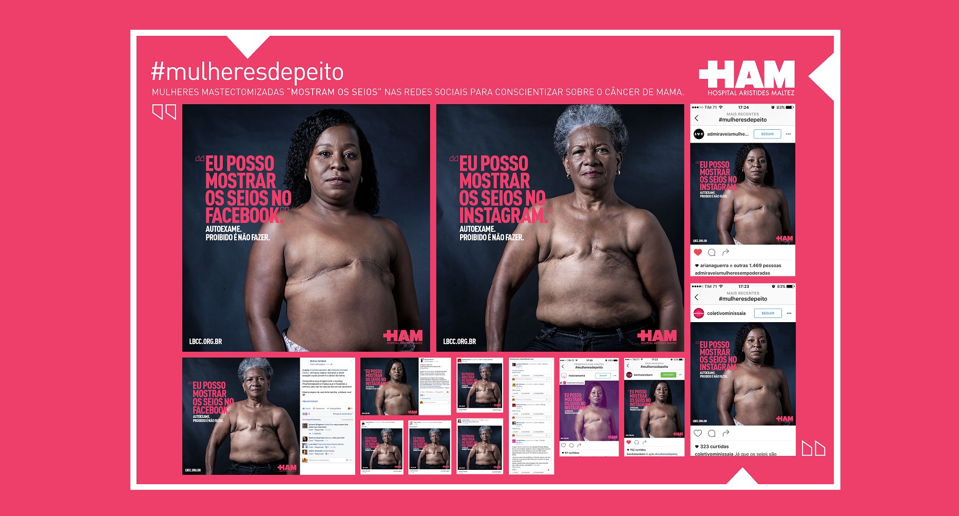 Mulheres mastectomizadas “mostram os seios” em campanha criada pela Propeg