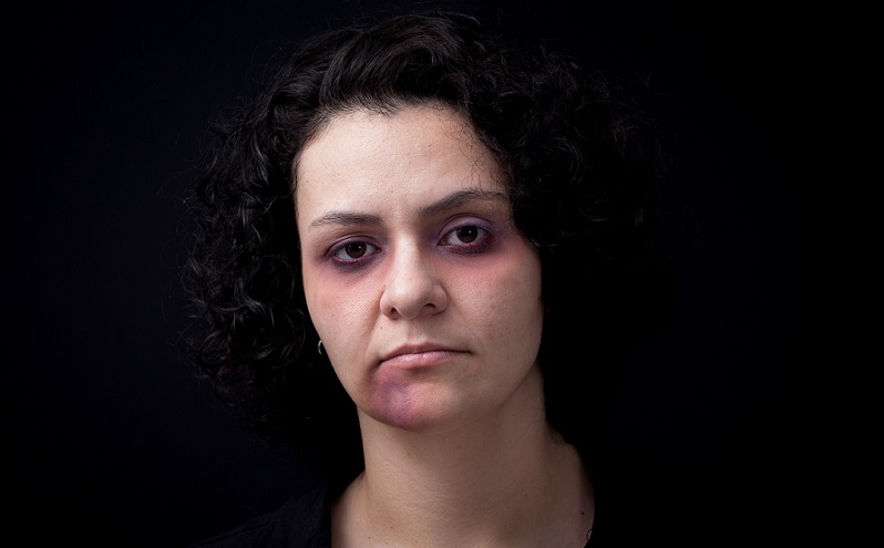 Cantora Karin Martins participa de campanha contra violência doméstica
