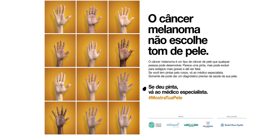 Campanha #MostraTuaPele destaca prevenção ao câncer melanoma