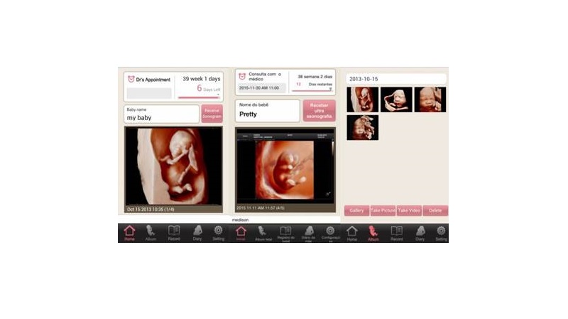 Samsung lança app que compartilha imagens do ultrassom do bebê