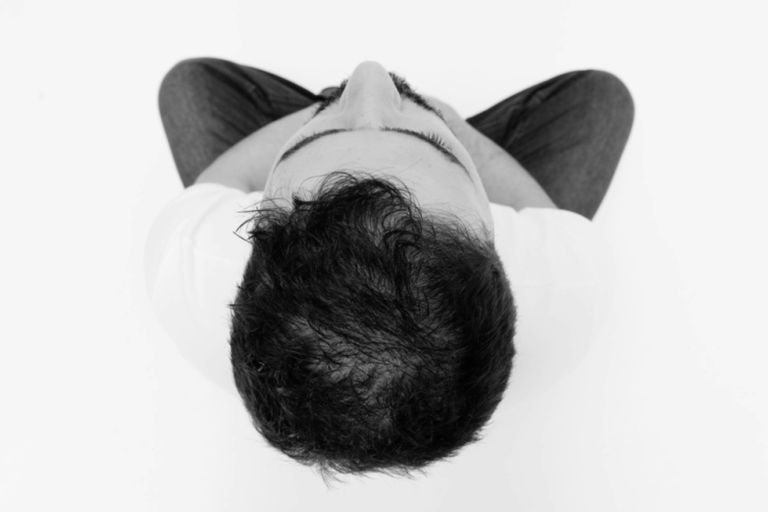 Campanha conscientiza sobre tumores cerebrais